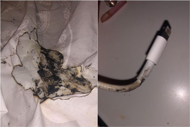 Birmingham teenager suffers facial burns after her iPhone charger caught fire
