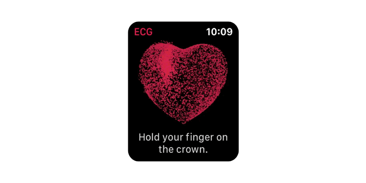 ECG app - Apple Watch